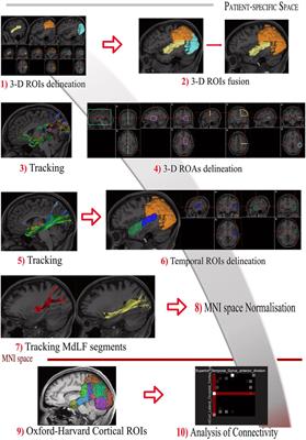 New Insights Into the Anatomy, Connectivity and Clinical Implications of the Middle Longitudinal Fasciculus